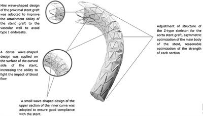 1-Year Outcomes of a Multicenter Randomized Controlled Trial of the Ankura II Thoracic Endoprosthesis for the Endovascular Treatment of Stanford Type B Aortic Dissections